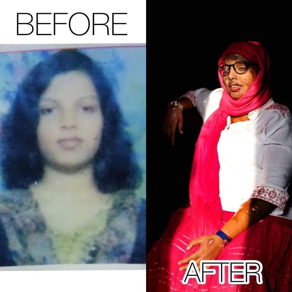 Pramodini Roul - Before and After
